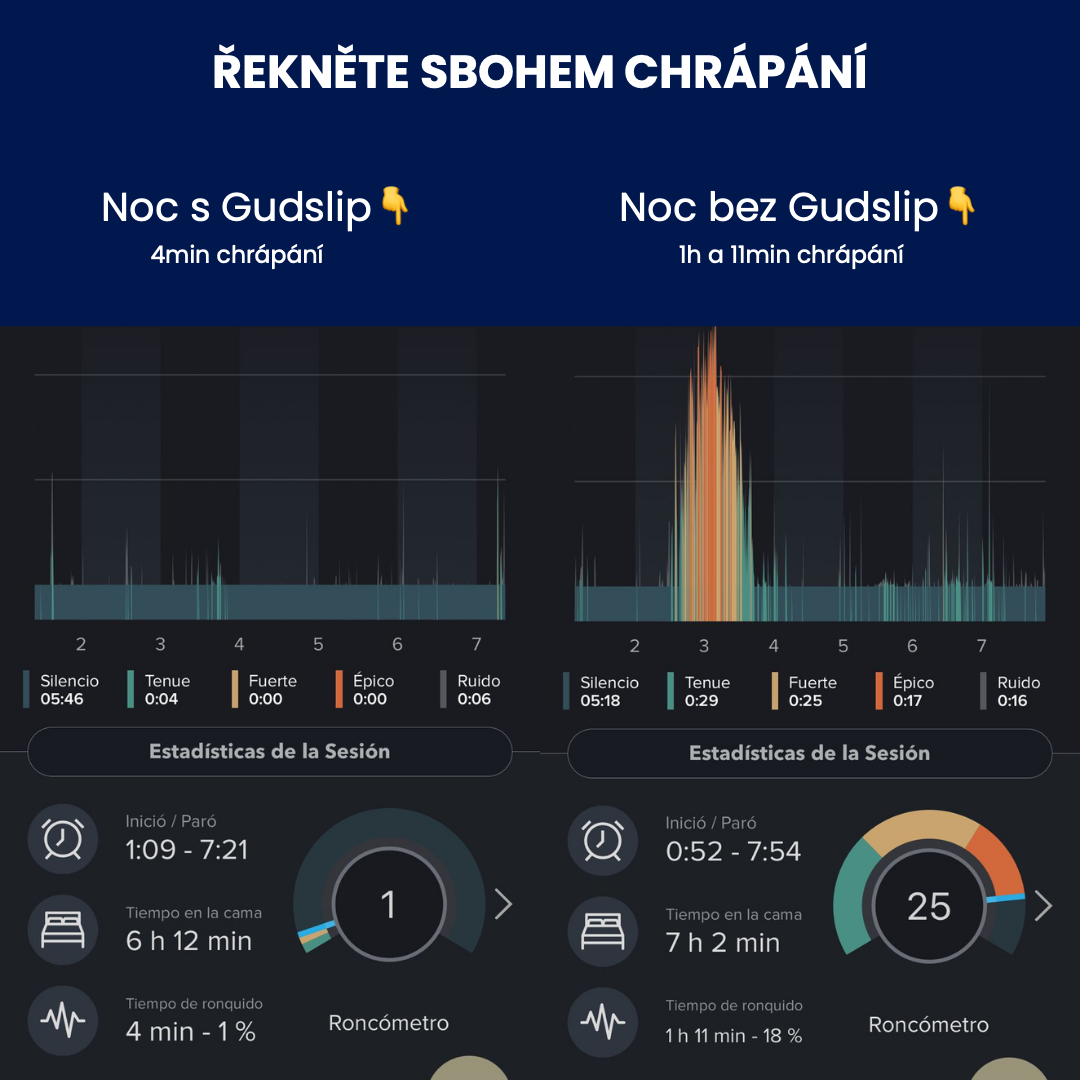 Gudslip® pásky na ústa (30ks)